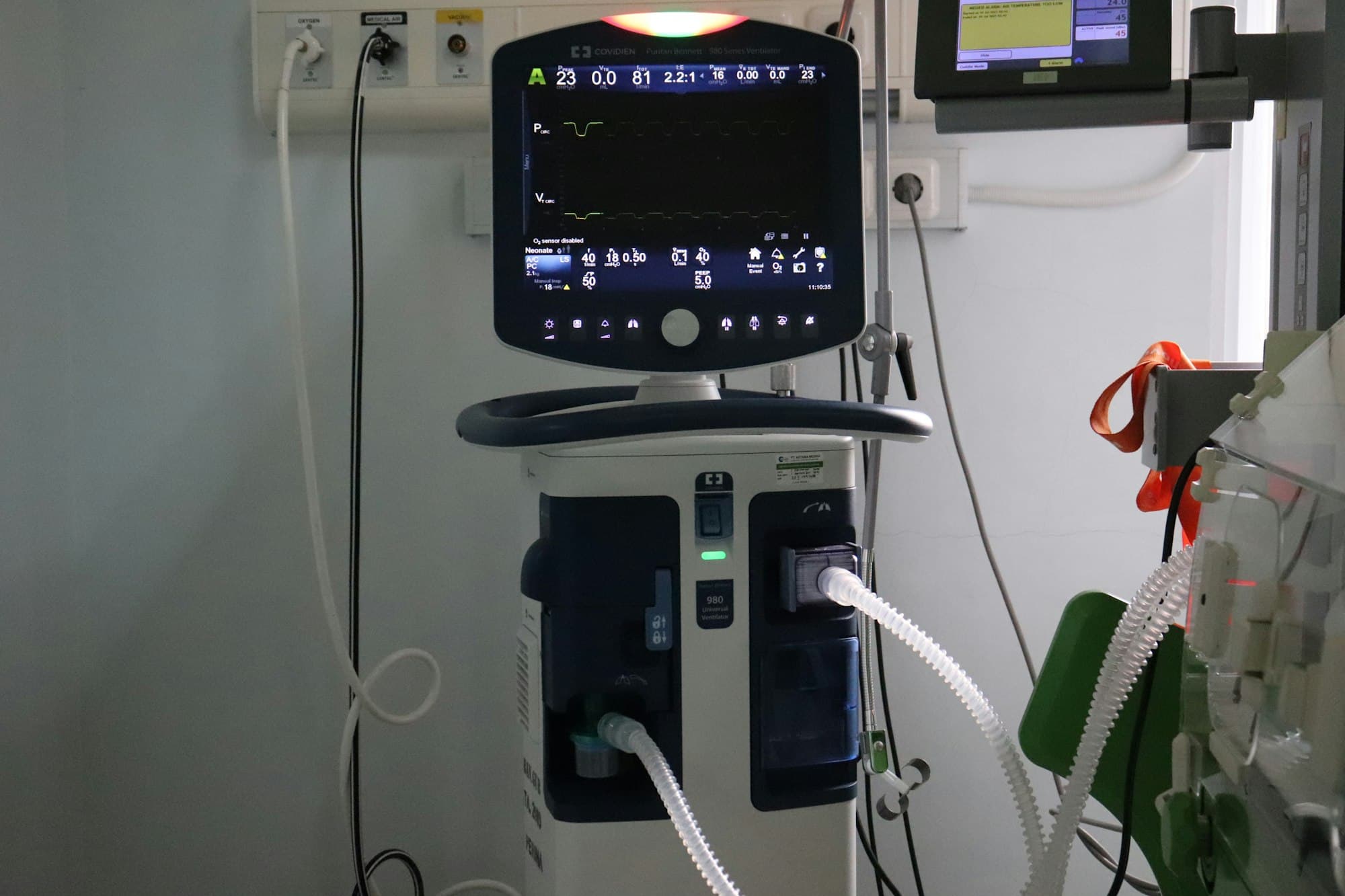 En patientmonitor och utrustning vid en sjukhussäng